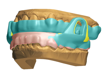 Orthoapnea en Valencia